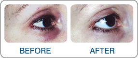 Eye Revive Serum 14ml